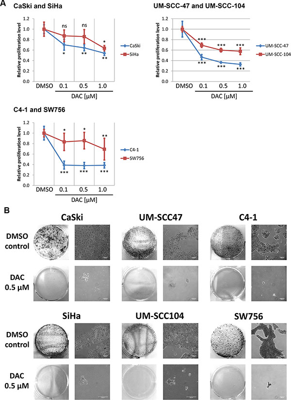 DAC treatment represses proliferation and colony formation of HPV 16 and 18 positive cervical carcinoma and HNSCC cell lines.