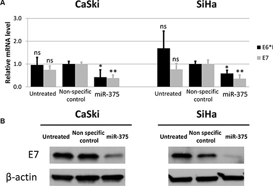 Transfection of miR-375 mimics reduces HPV oncogene levels in CaSki and SiHa cells.