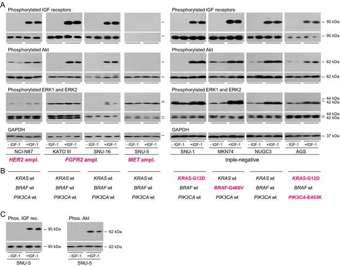 Activation of signal transduction pathways in gastric cancer cells.