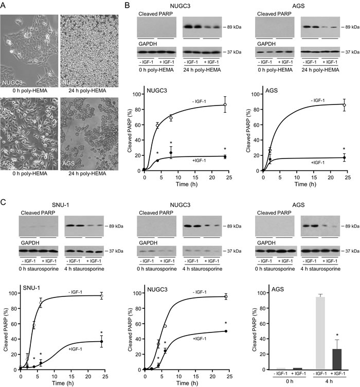 Protective effect of IGF-1 against anoikis and apoptosis in triple-negative gastric cancer cells.