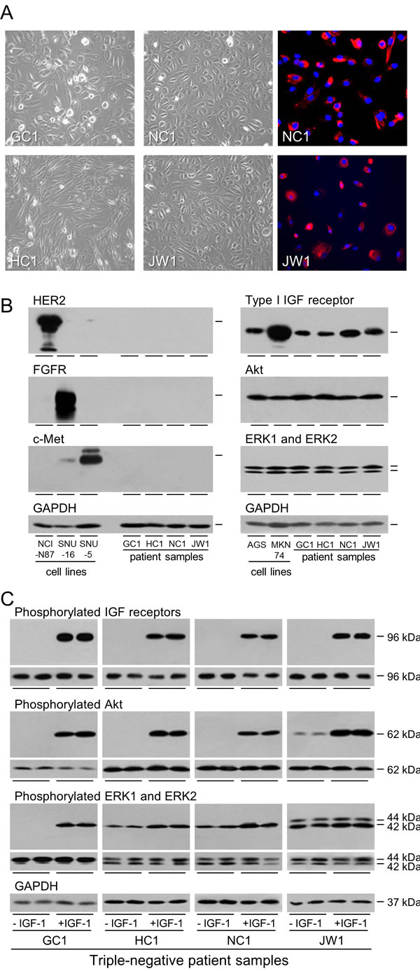 Expression and activation of the IGF signal transduction pathway in patient samples.