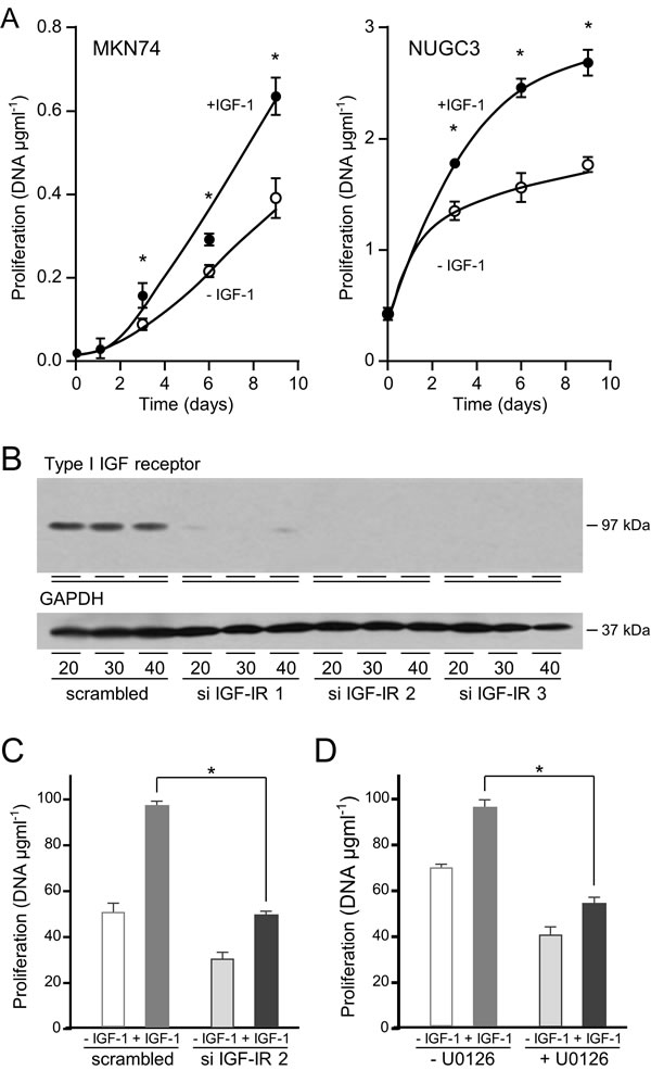 IGF-1 stimulates gastric cancer cell proliferation