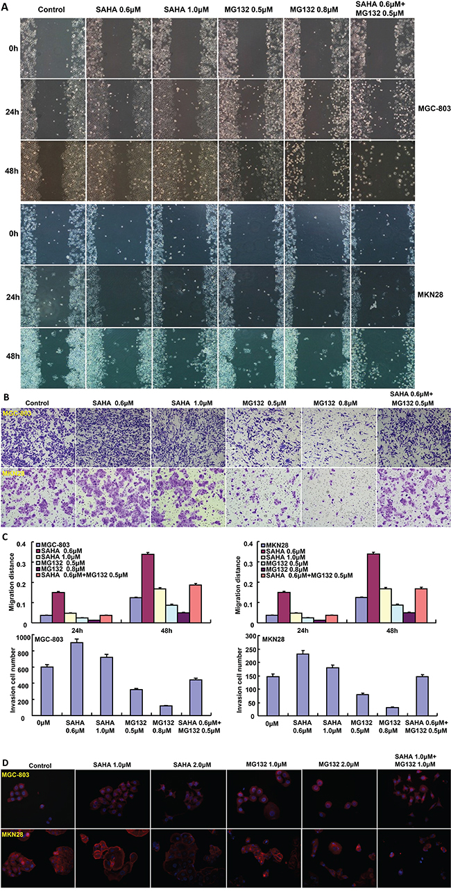 The effects of SAHA on migration and invasion of gastric cancer cells.