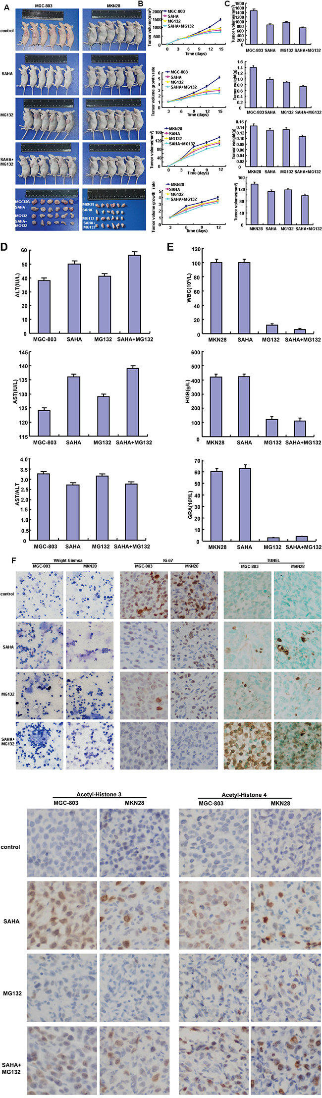 The inhibitory effects of SAHA and MG132 treatment on the tumor growth of gastric cancer cells in xenograft model.