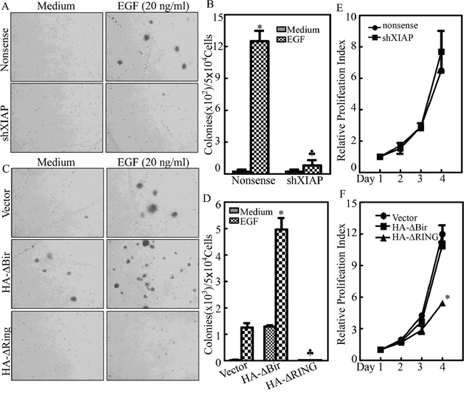 XIAP RING domain upregulated EGF induced bladder cell transformation.