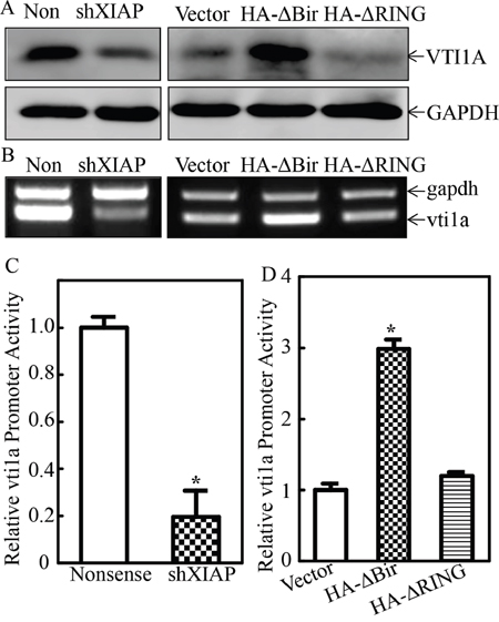 XIAP RING domain promoted miR-4295 host gene VTI1A transcription in human bladder epithelial cells.