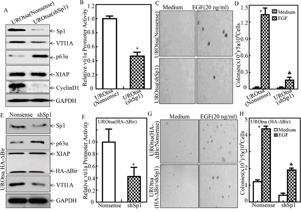 Sp1 was crucial for VTI1A transcription, p63&#x03B1; expression and EGF-induced malignant transformation of human bladder epithelial cells.