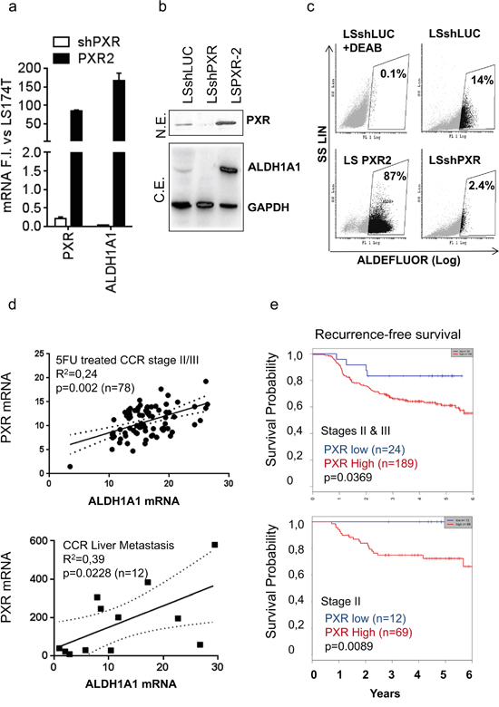 PXR mRNA expression correlates with ALDH1A1 expression and is a poor prognosis factor in colon cancer patients.