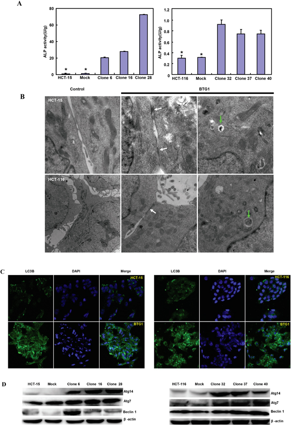 The effects of BTG1 overexpression on differentiation and autophagy of colorectal cancer cells.