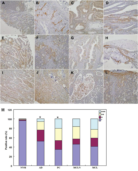 Immunohistochemical staining of BTG1 during colorectal carcinogenesis.