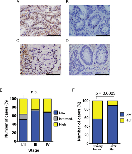 pY88 paxillin is upregulated in colorectal cancer tissues.