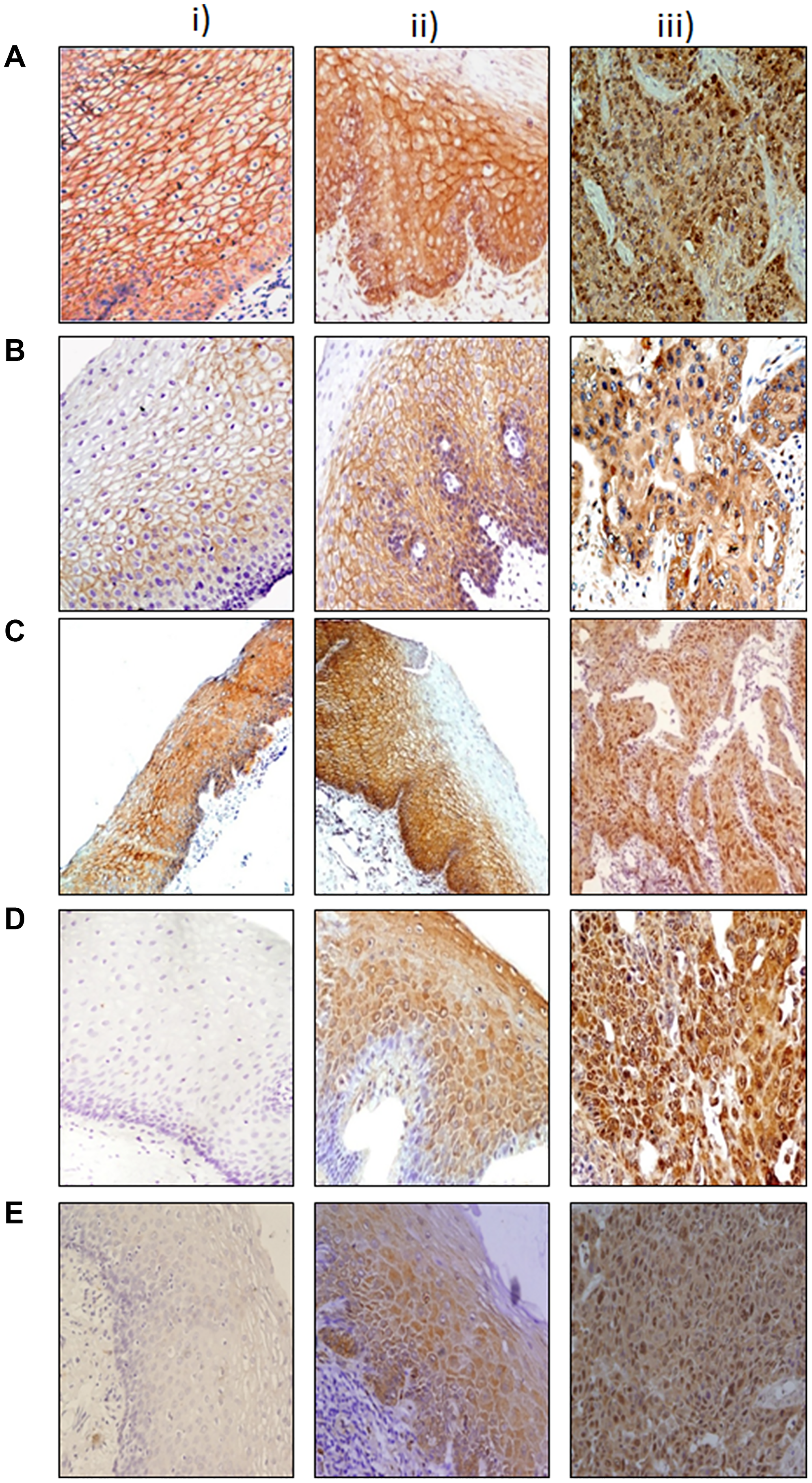 Immunohistochemical analysis of Wnt protein in esophageal tissues.