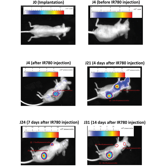 Metastasis analysis in an orthotopic model.