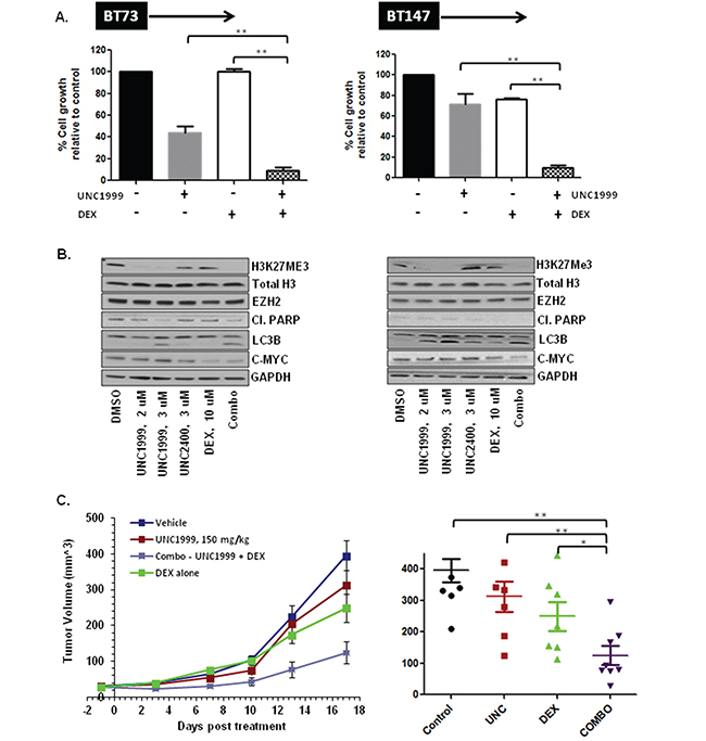 UNC1999 is synergistic with dexamethasone (DEX) in vitro and suppresses tumor growth in vivo in a flank xenograft model.