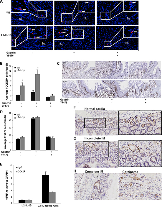 Gastrin-dependent expansion of CCK2R+ cells in Barrett&#x2019;s-like metaplasia.