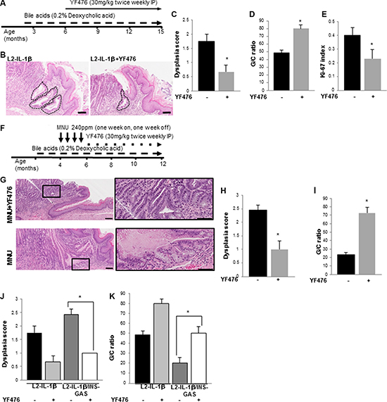 CCK2R blockade prevents the development of Barrett&#x2019;s-like esophagus in L2-IL-1&#x03B2; mice.