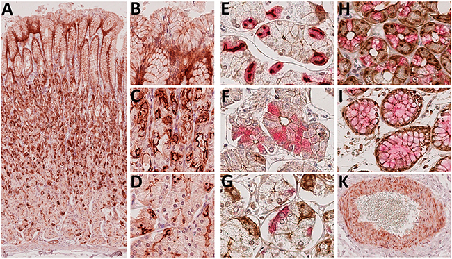 Immunohistochemical detection of Troy&#x002B; cells in the gastric corpus mucosa.
