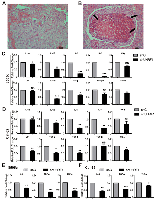 Down-regulated UHRF1 suppresses the inflammatory reaction of ATC.