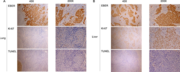 Proliferation and apoptotic indices in different sites of single organ metastases.