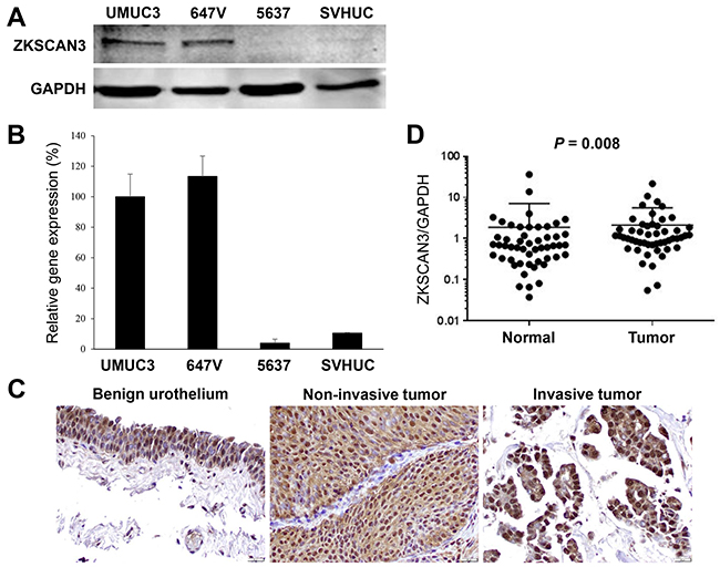 ZKSCAN3 expression in bladder cancer.