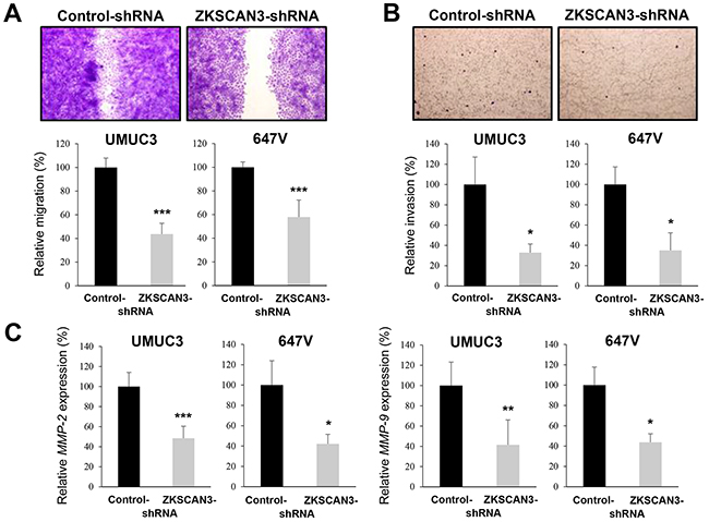 Effects of ZKSCAN3 inactivation on bladder cancer cell migration and invasion.