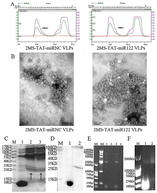 Identification of 2MS-TAT-miR122 VLPs and its negative control.