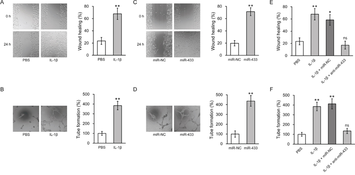 miR-433 was required for IL-1&#x03B2;-induced enhancement of angiogenesis in hL-MSC derived endothelial cells.