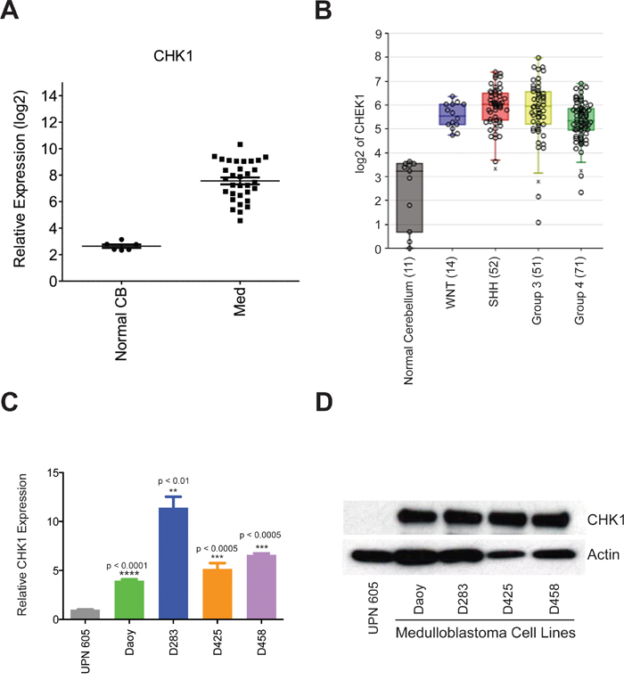 CHK1 is overexpressed in medulloblatoma.