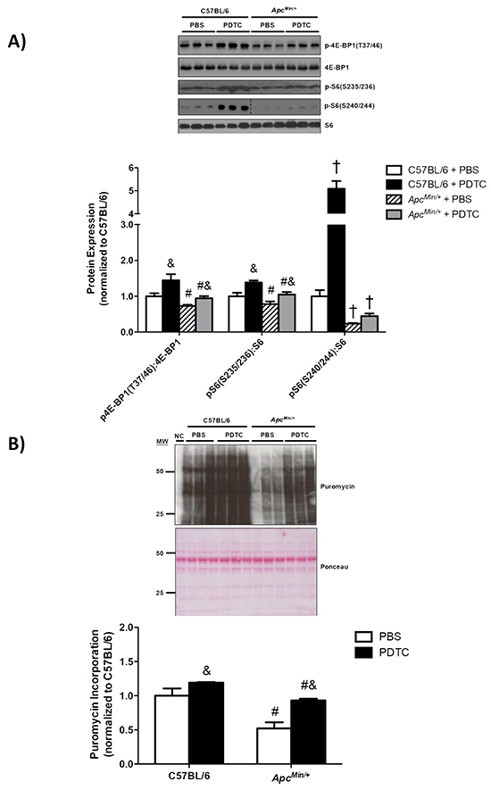The effect of PDTC treatment on muscle protein turnover regulation in ApcMin/+ mice.