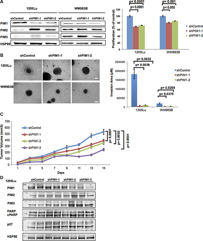 Effects of PIM1 knockdown on melanoma cells.