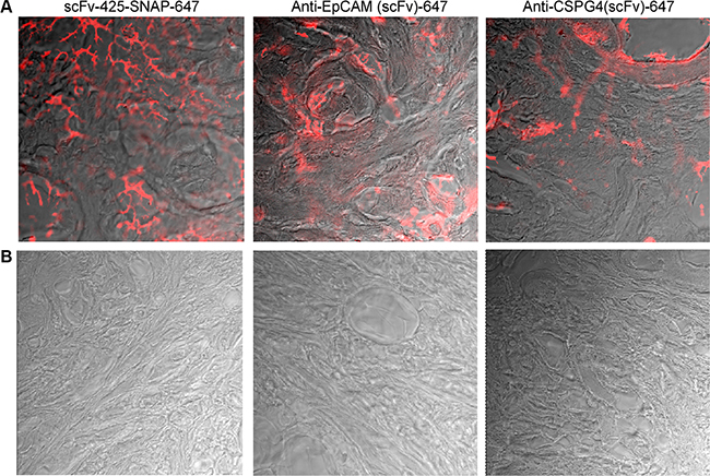 Fluorescence immunohistochemistry of scFv-SNAP-Alexa Fluor&#x00AE;647-labeled proteins against EGFR, EpCAM and CSPG4 in human breast cancer tissues (A) and normal breast tissue (B).