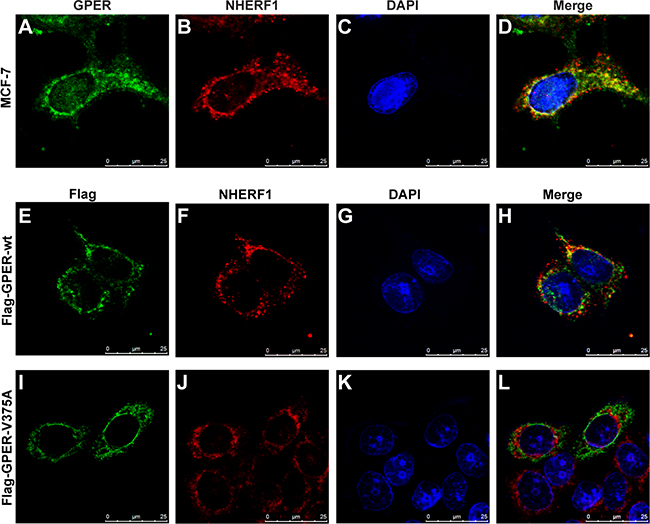 NHERF1 co-localizes with GPER in MCF-7 cells.
