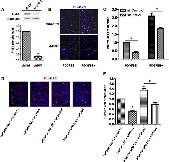 PIM-1 knockdown rescues proliferating PASMCs by inhibition of miR-328.