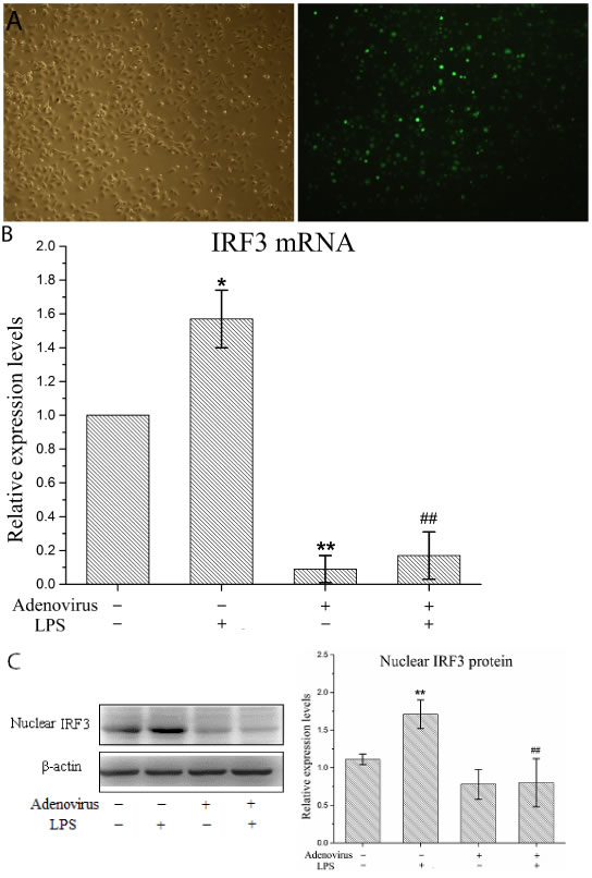 Interference adenovirus knockdowns IRF3 expression in LPS-stimulated KCs.
