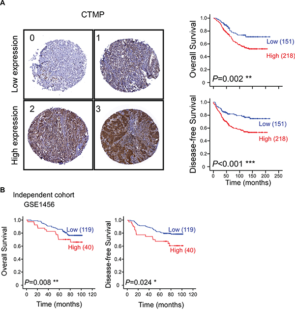 High CTMP expression is associated with poor survival and early recurrence in breast cancer patients.