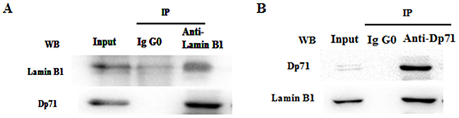Dp71 interacts with lamin B1 in GES-1 cells.