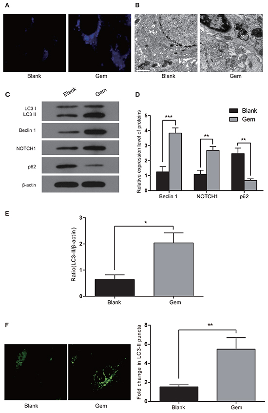 Gem treatment increases autophagosome- and autophagy-related protein expression in MDA-MB-231 cells.