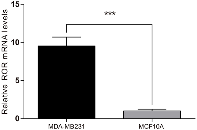Linc-ROR expression in MDA-MB-231 and MCF10A cells by reverse transcription polymerase chain reaction (RT-PCR).
