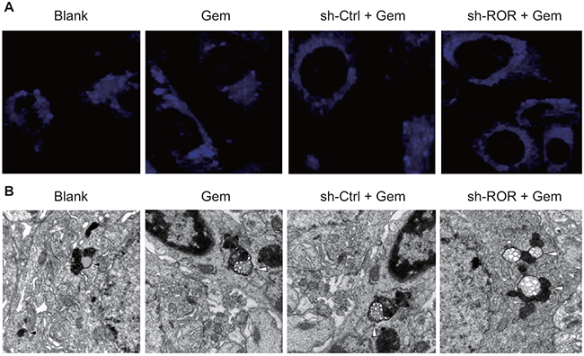 Linc-ROR influences autophagosome assembly in Gem-treated MDA-MB-231 cells.