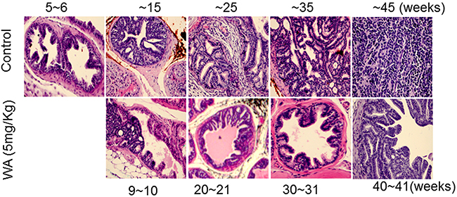 Control and WA-treated mice were periodically sacrificed, and prostate tumor tissues were subjected to H&#x0026;E analysis.