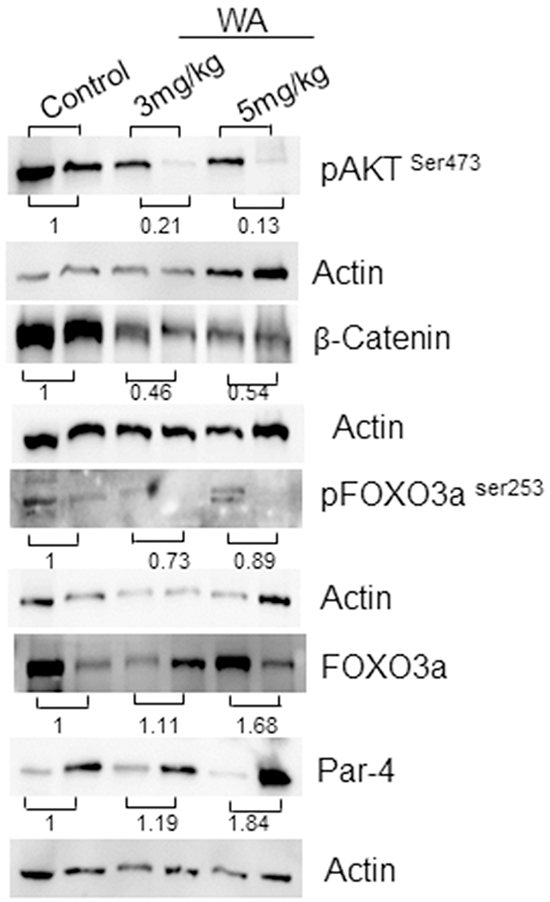 Western blot analysis in control and WA-treated prostate tumor tissues.