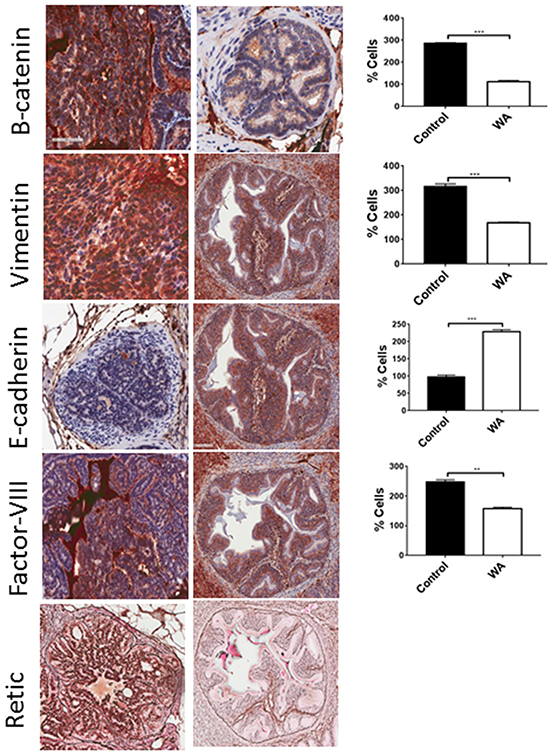 Immunohistochemical staining for EMT markers.