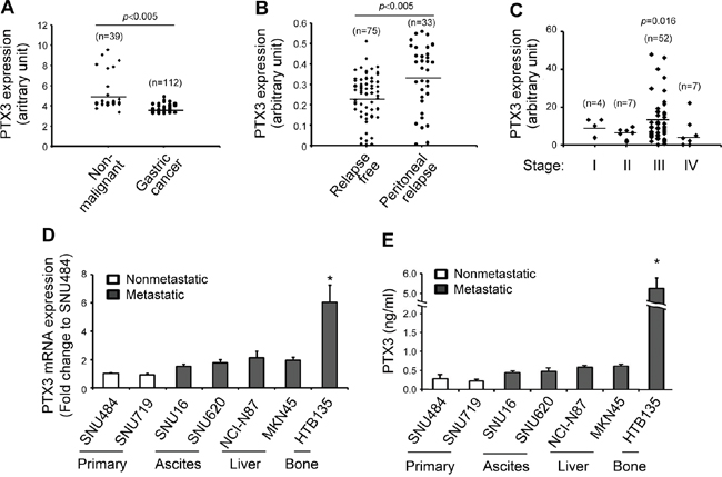 Comparison of long pentraxin3 (PTX3) expression levels in gastric cancer patients, advanced human gastric cancers, and bone metastatic gastric cancer cells.