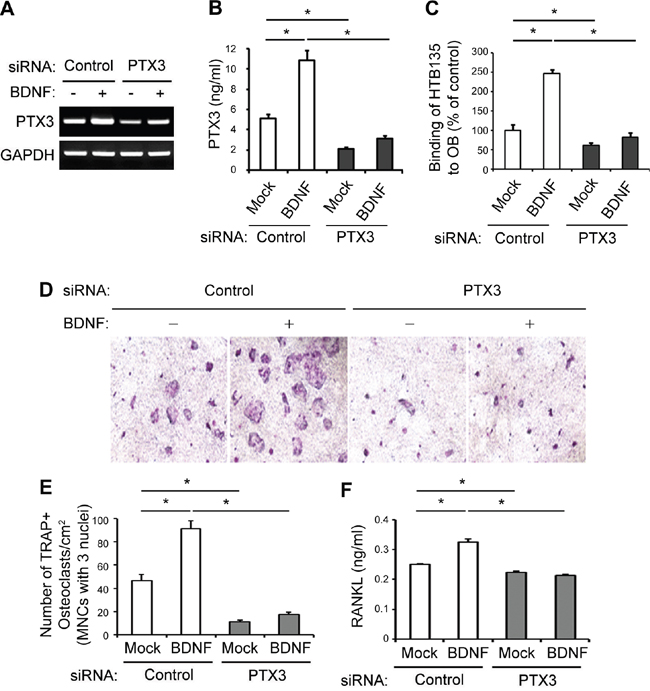 BDNF-derived PTX3 promotes bone metastatic gastric cancer cell binding to OBs and subsequent osteoclast (OC) formation.