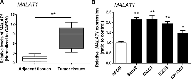 Upregulation of MALAT1 expression in human osteosarcoma tissues and cells.