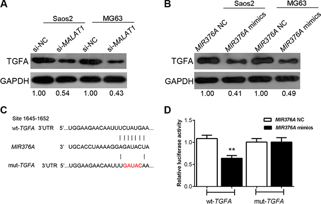 Regulation of TGFA by manipulation of MALAT1 and MIR376A in human OS cells and TGFA as a direct target of MIR376A.