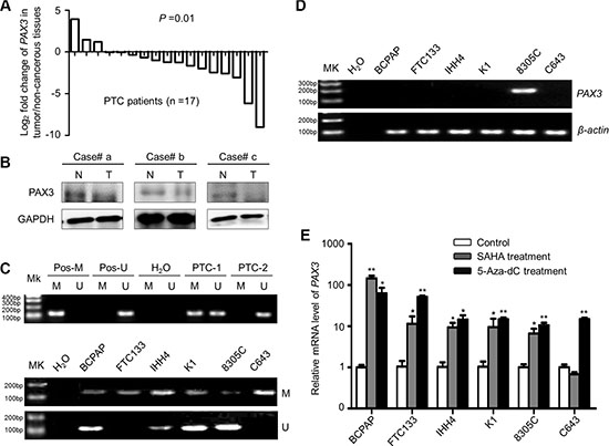 PAX3 inactivation by promoter hypermethylation in primary PTCs and thyroid cancer cell lines.