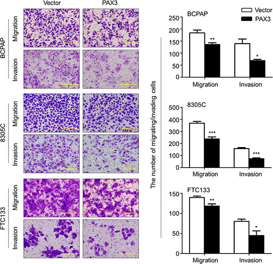 Inhibition of thyroid cancer cell migration and invasion by PAX3.