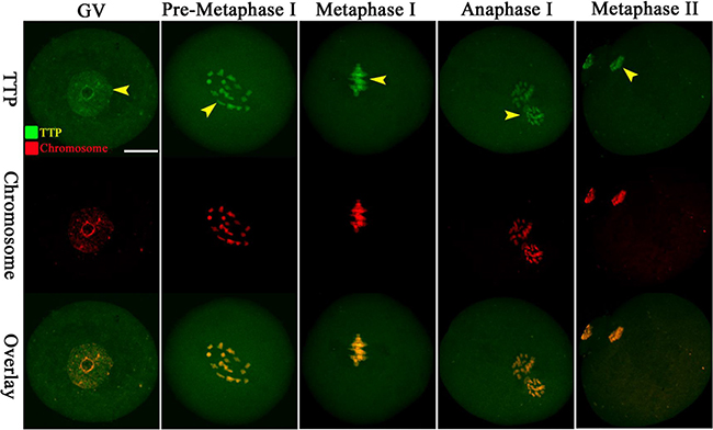 Cellular localization of TTP in mouse oocytes.