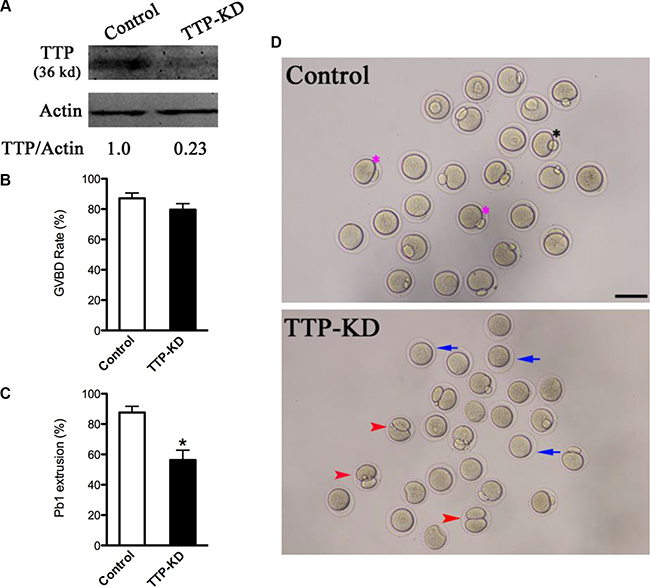 Effects of TTP knockdown on oocyte maturation.
